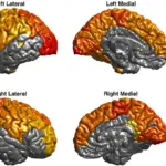 brain emotions czech scientists research MRI