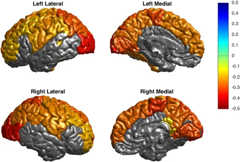 brain emotions czech scientists research MRI