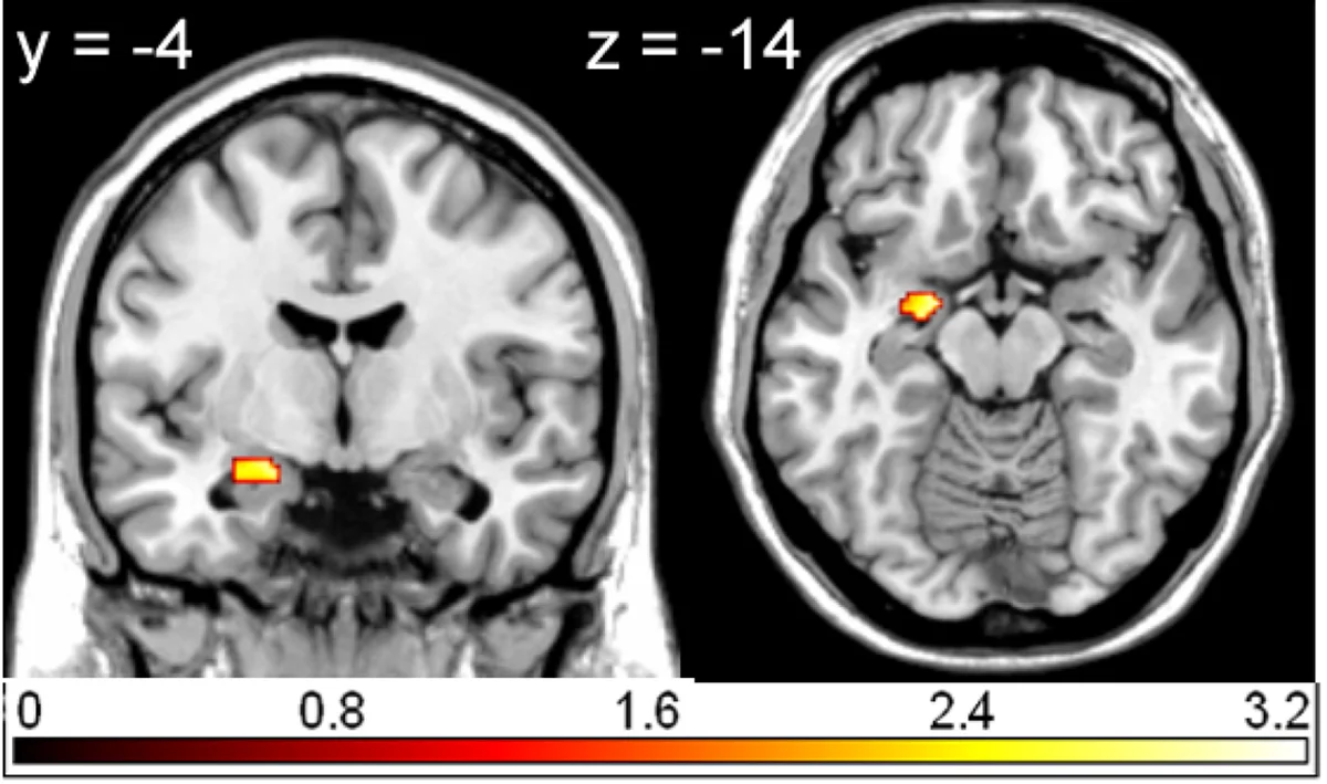 emotional response brain scan czech study