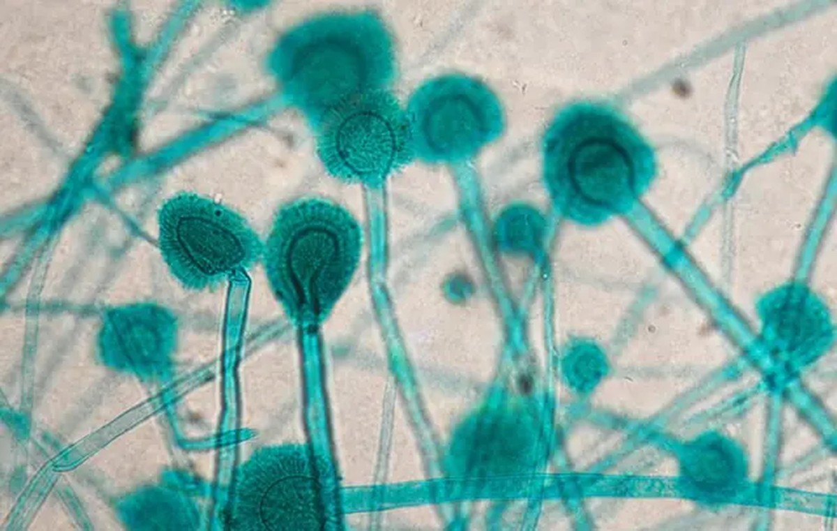 Úloha klimatických změn při vzniku kvasinkových infekcí u žen