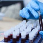 Vědci identifikovali nový typ krve považovaný za nejvzácnější na světě — patří jediné ženě