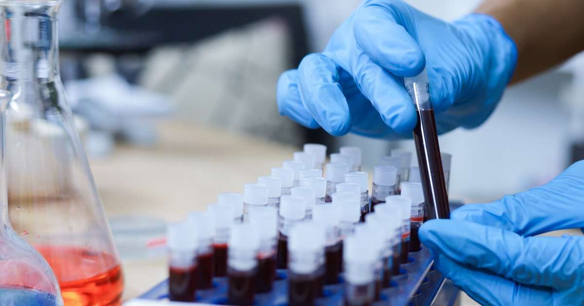 Vědci identifikovali nový typ krve považovaný za nejvzácnější na světě — patří jediné ženě